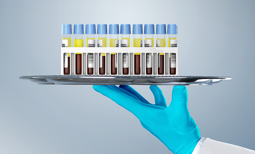 Hemostasis_samples_834x506_v1 Hemostasis image
